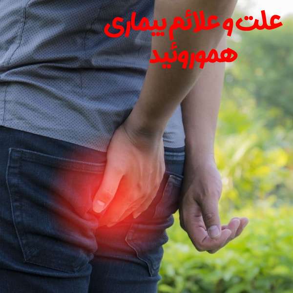 هموروئید یا بواسیر چه علائمی دارد؟