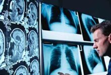 لیست آدرس و تلفن مراکز رادیولوژی و سونوگرافی در شهر رشت و حومه