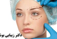 آدرس و تلفن پزشکان متخصص جراحی زیبایی پلک و بلفاروپلاستی در بوشهر