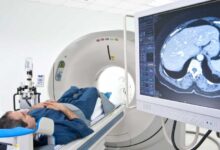 آدرس و تلفن مراکز ام آر آی (MRI) در شهر بیرجند