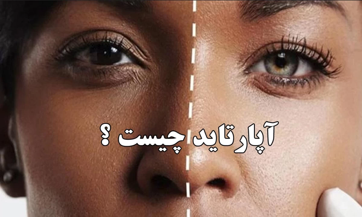 معنی آپارتاید چیست ؟ معنی آپارتاید چیست ؟