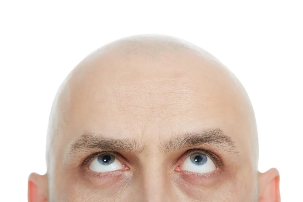 تعبیر خواب کچل شدن 👴 (کامل و رایگان | از نظر معبران و موضوعات مختلف)