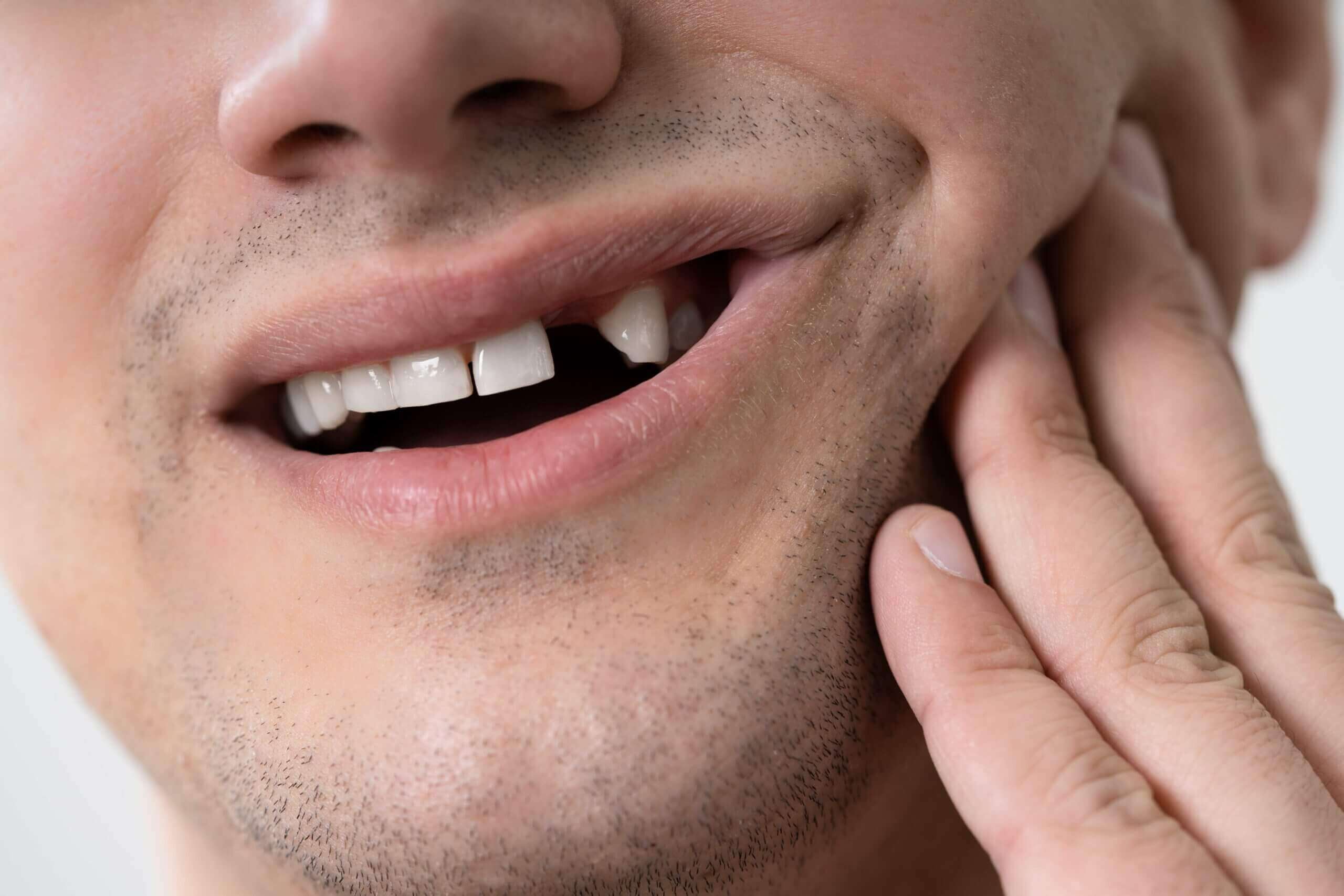 تعبیر خواب شکستن دندان 🦷 (کامل و رایگان | از نظر معبران و موضوعات مختلف)