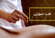 بهترین متخصص طب سوزنی در خرم آباد + آدرس و تلفن