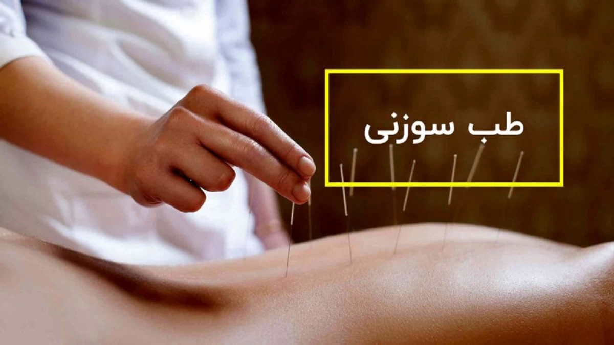 بهترین متخصص طب سوزنی در خرم آباد + آدرس و تلفن