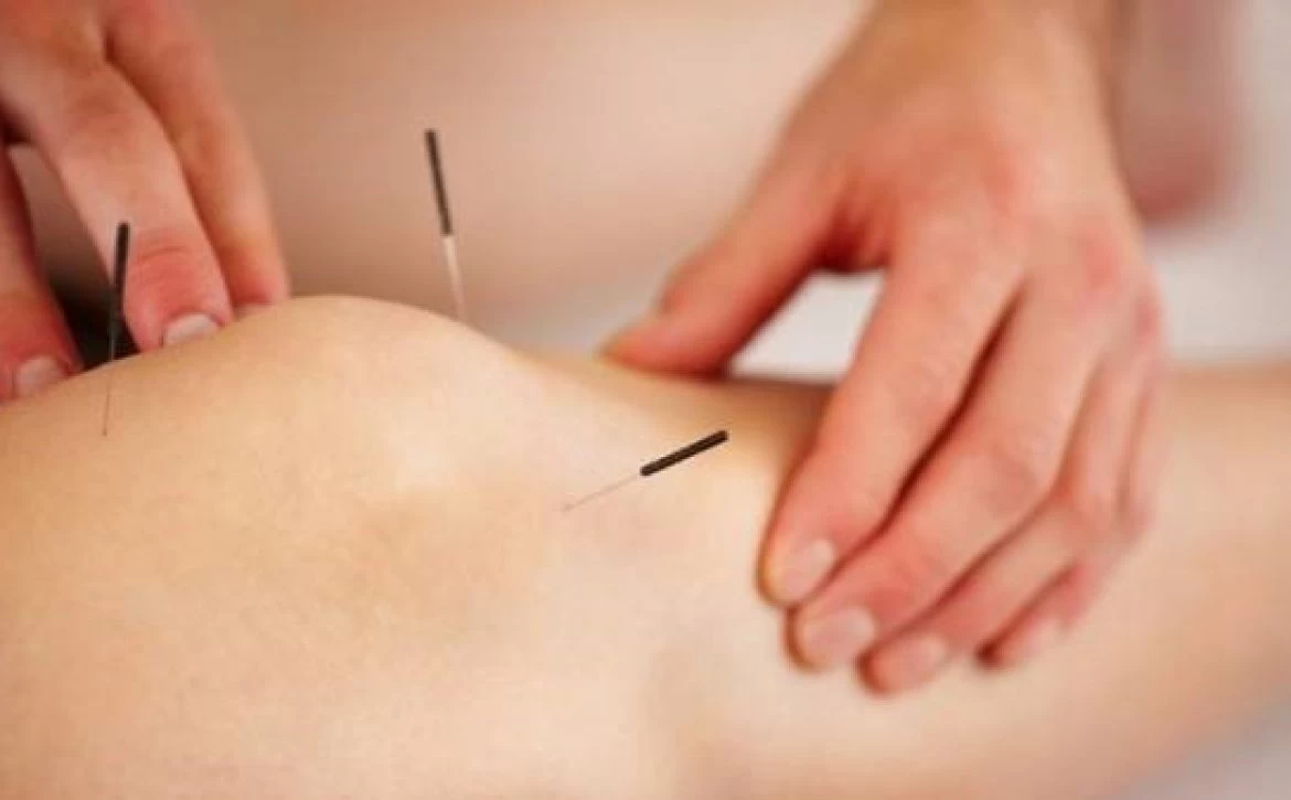 بهترین متخصص طب سوزنی در شیراز + آدرس و تلفن بهترین متخصص طب سوزنی در شیراز + آدرس و تلفن