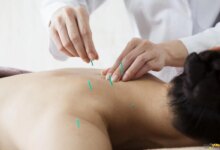 بهترین متخصص طب سوزنی در مشهد + آدرس و تلفن