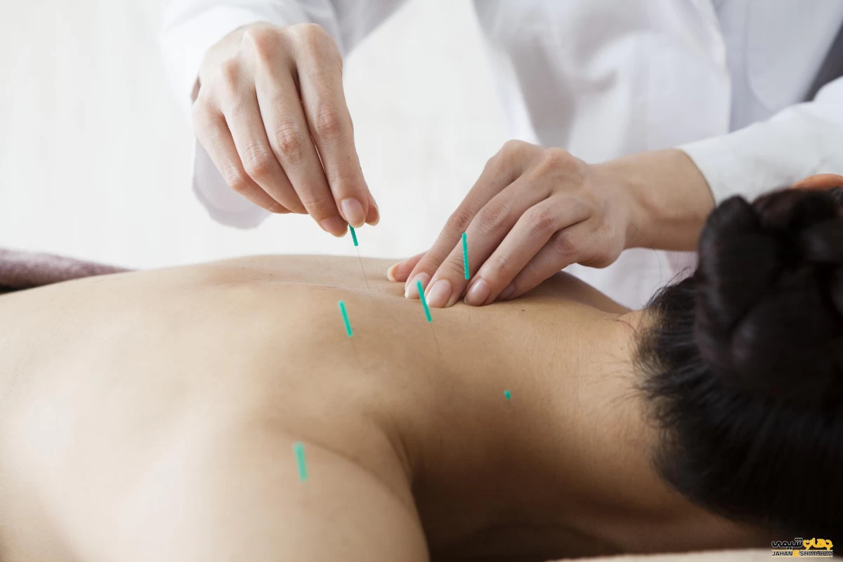 بهترین متخصص طب سوزنی در مشهد + آدرس و تلفن بهترین متخصص طب سوزنی در مشهد + آدرس و تلفن
