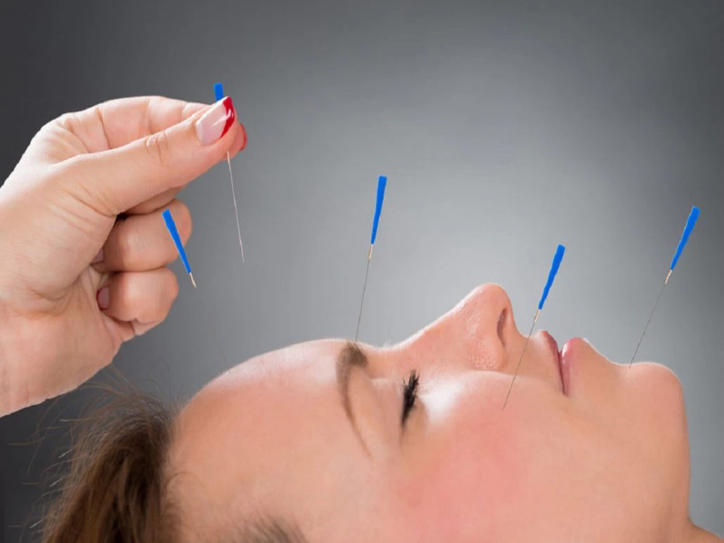 بهترین متخصص طب سوزنی در کرمانشاه + آدرس و تلفن بهترین متخصص طب سوزنی در کرمانشاه + آدرس و تلفن