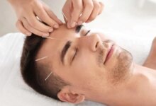 بهترین متخصص طب سوزنی در یزد + آدرس و تلفن