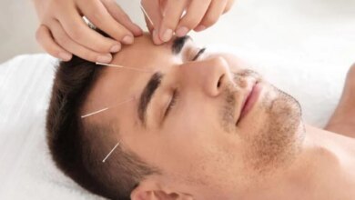 بهترین متخصص طب سوزنی در یزد + آدرس و تلفن