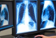 لیست آدرس و تلفن مراکز رادیولوژی و سونوگرافی در کرمانشاه و حومه