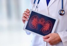 لیست بهترین متخصص جراحی کلیه مجاری ادراری در تهران + آدرس و تلفن