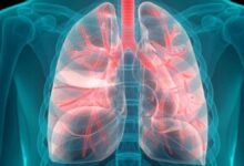 پزشکان فوق تخصص ریه در بندرعباس به همراه آدرس و تلفن
