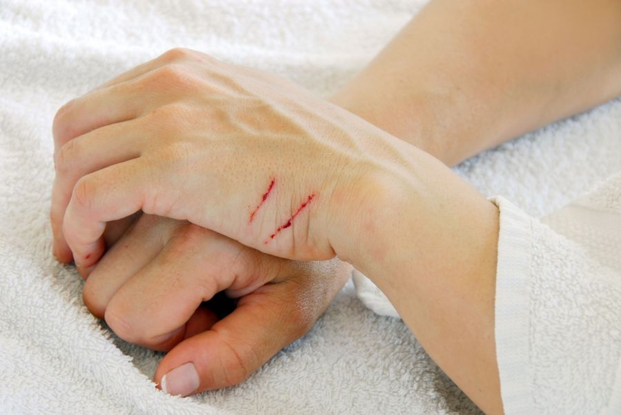 خوب نشدن زخم چه علتی دارد؟ (2 نکته مهم)
