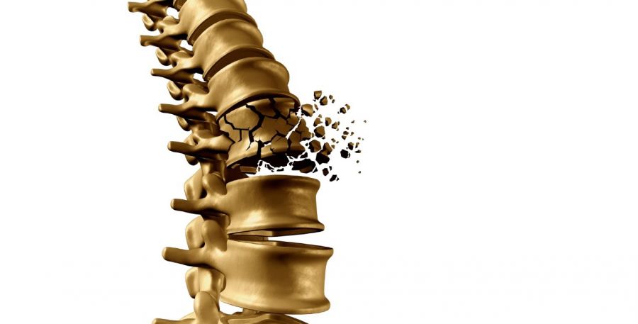 راه های جلوگیری از پوکی استخوان کدام است؟ (2 نکته مهم)