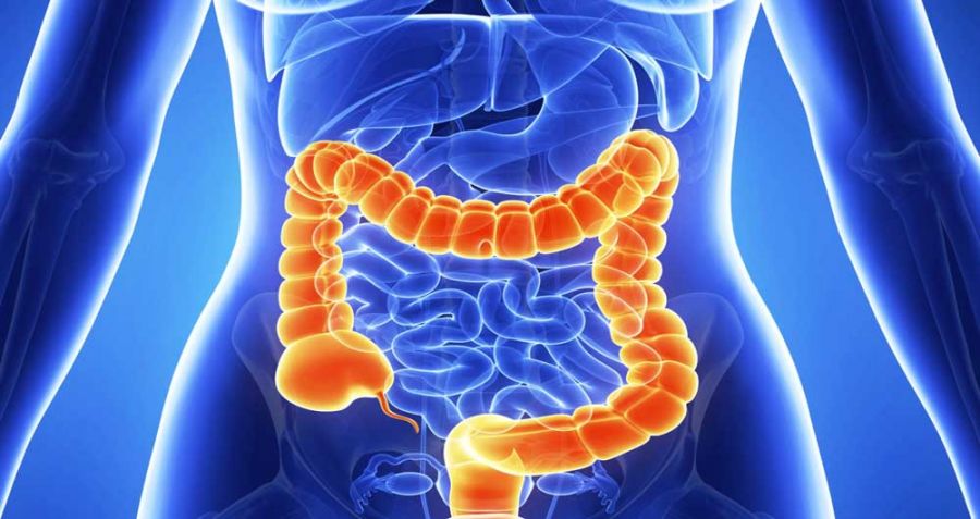 علائم ولولوس (پیچ خوردگی روده) چیست و چگونه درمان میشود ؟ (2 نکته مهم)