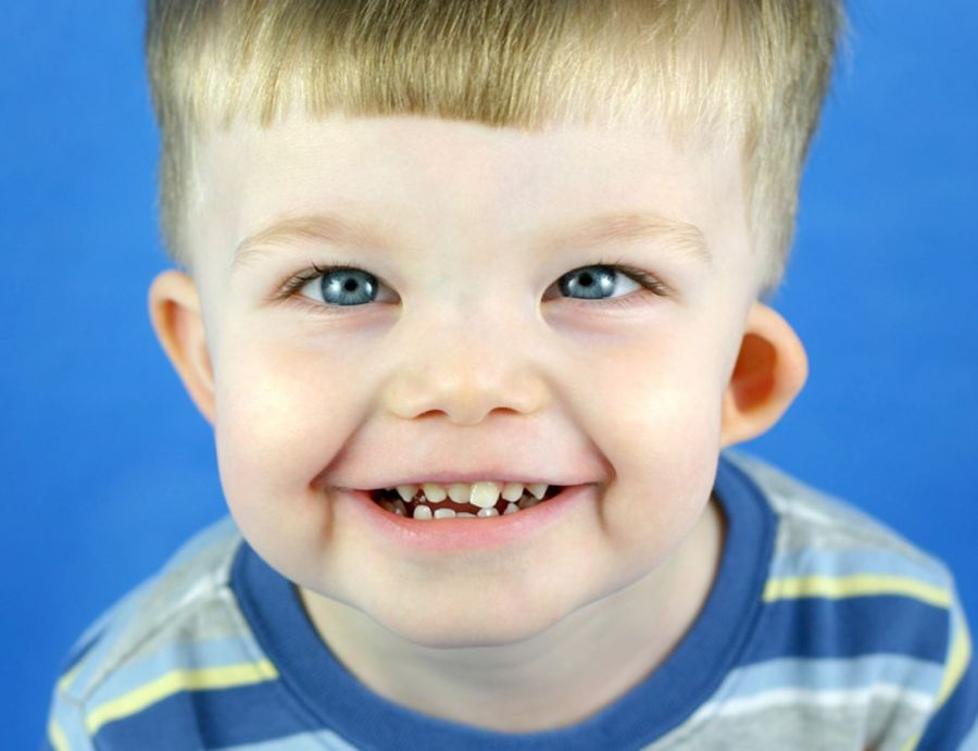 مهمترین علائم سندرم ویلیامز چیست؟ (2 نکته مهم)