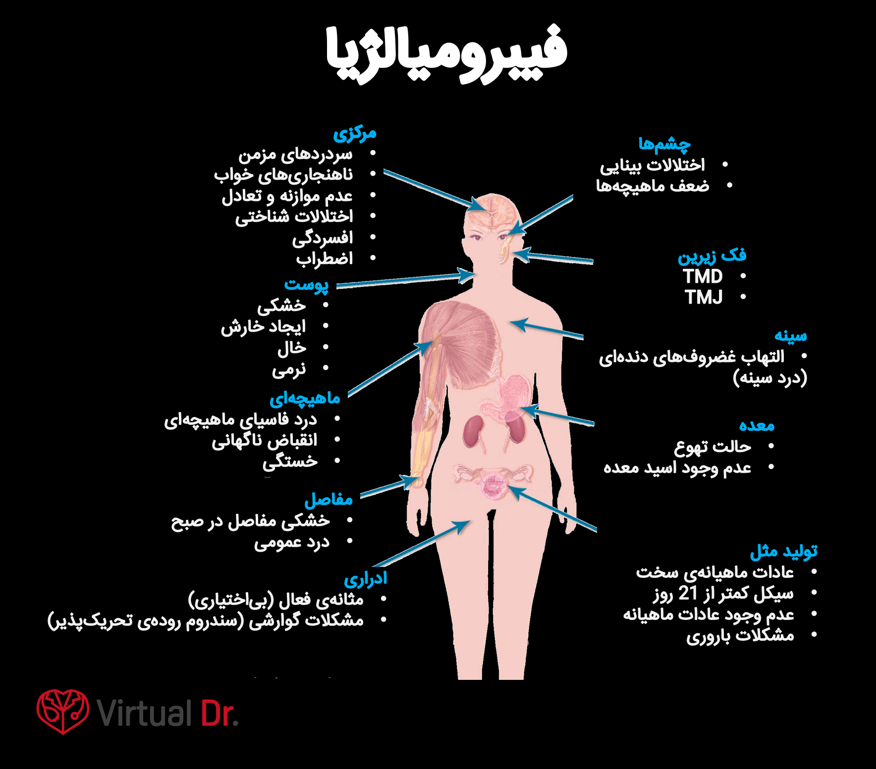  فیبرومیالژیا