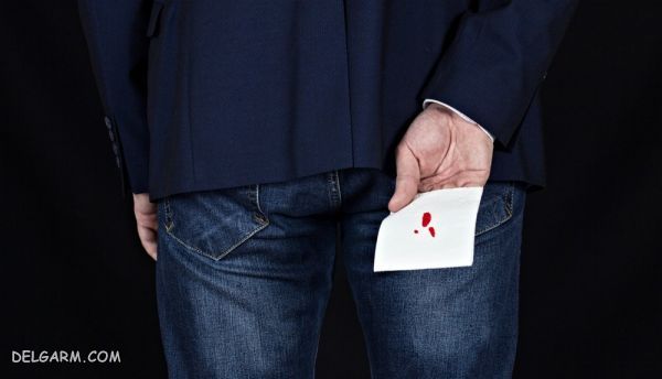 بواسیر ، هموروئید