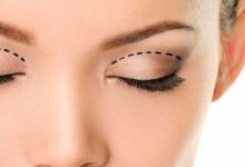 آدرس و تلفن پزشکان متخصص جراحی زیبایی پلک و بلفاروپلاستی در کرج