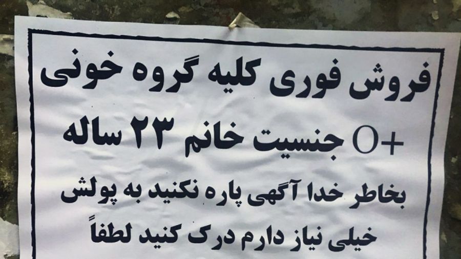 خرید و فروش کلیه و تمام مشکلاتی که در پی دارد !