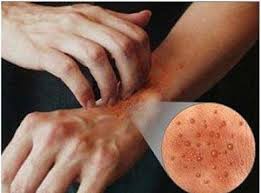  آلودگی هوا 
