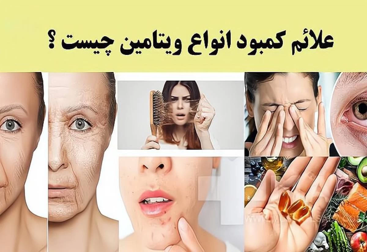چگونه بفهمیم کدام ویتامین بدنمان کم است؟ (2 نکته مهم)