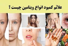 چگونه بفهمیم کدام ویتامین بدنمان کم است؟ (2 نکته مهم)