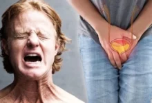 دلیل مبتلا شدن به سرطان پروستات (2 نکته مهم)