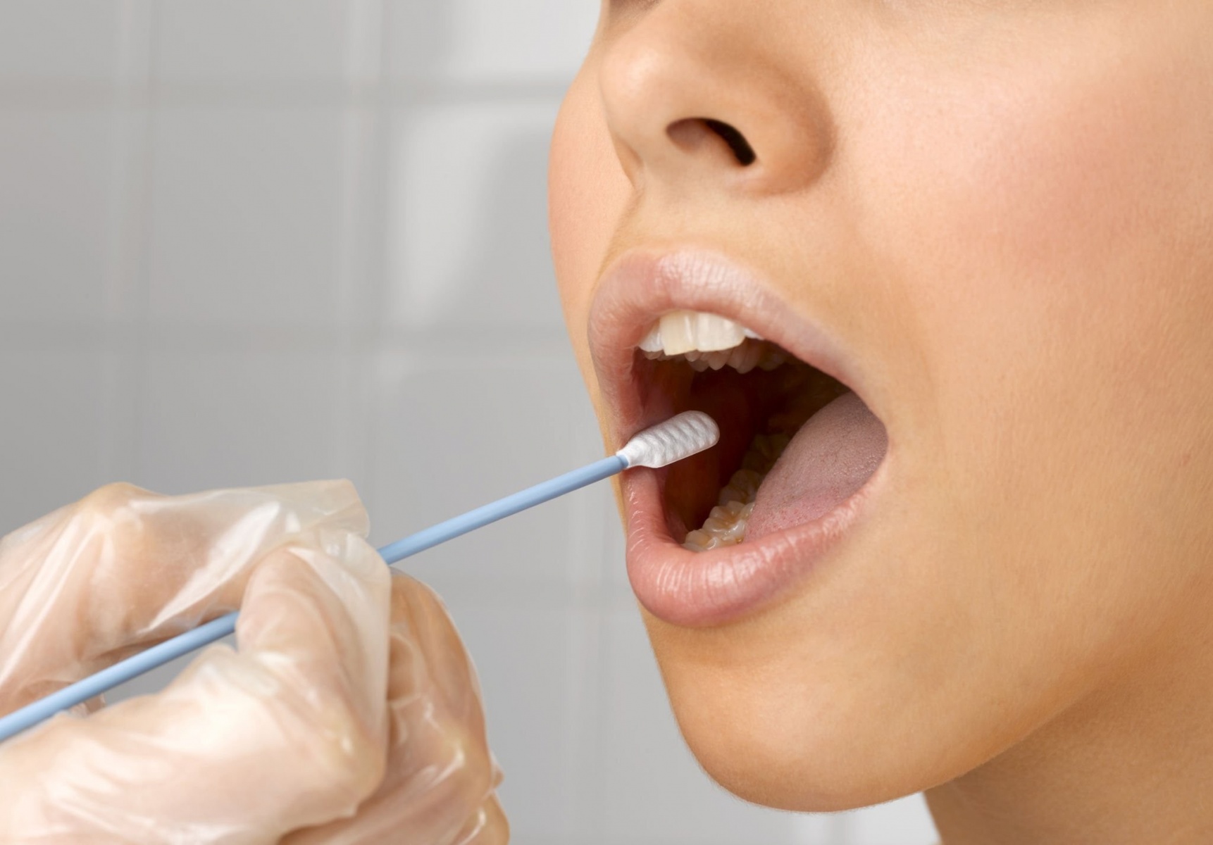 دلایل زرد شدن رنگ زبان چیست؟ آیا خطرناک است؟ (2 نکته مهم)