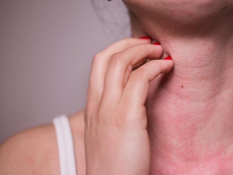 چگونه با آلرژی فصلی مقابله کنیم؟