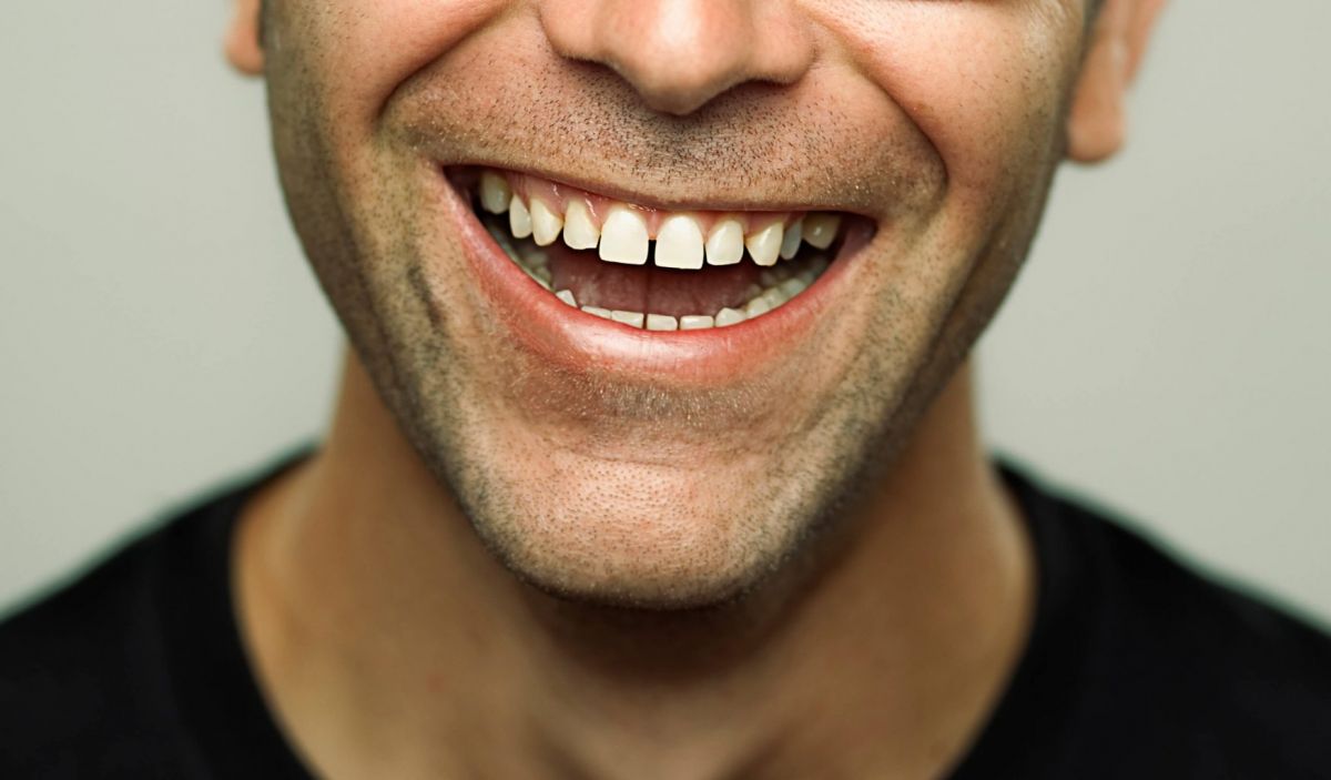 فاصله بین دندانی یا دیاستما چیست؟ (2 نکته مهم)