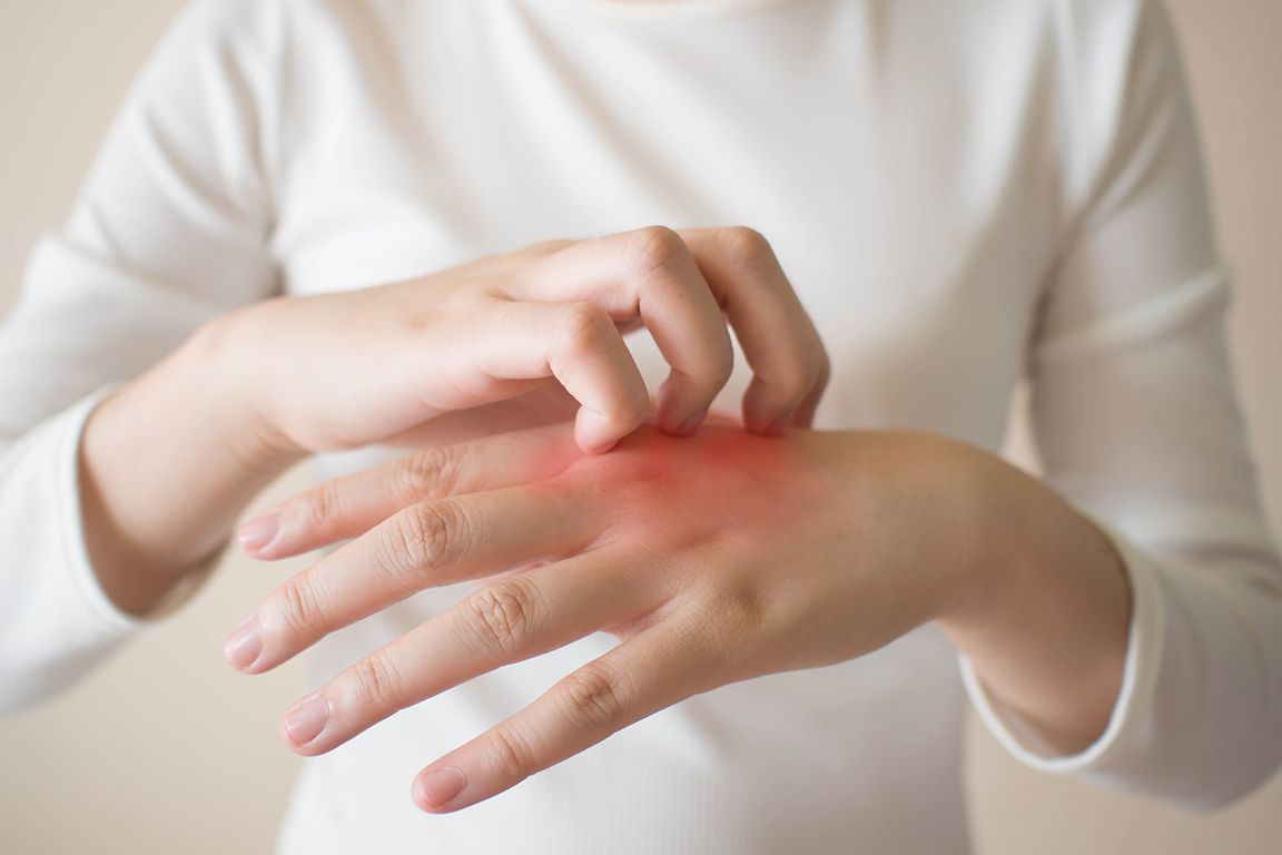 حسایت به تخم مرغ چه دلایلی دارد؟