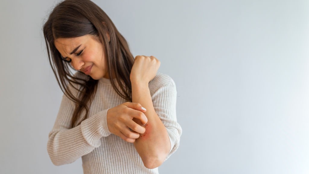 فرق بین بیماری کهیر حاد و مزمن چیست؟ (2 نکته مهم)