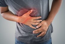 آیا همانژیوم کبدی رشد می کند؟ (2 نکته مهم)