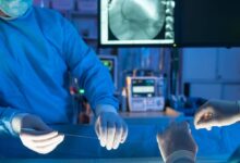 مراقبت های بعد از آنژیو پلاستی (Angioplasty) یا فنر گذاشتن قلب (2 نکته مهم)