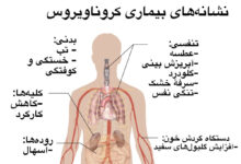 علائم و نشانه های کرونا به چه ترتیبی ظاهر می شوند ؟ (2 نکته مهم)