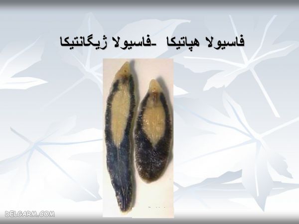 بیماری فاسیولا چیست ؟