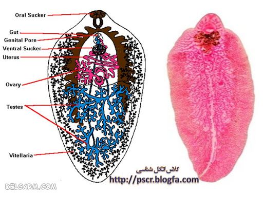 بیماری فاسیولا چیست ؟
