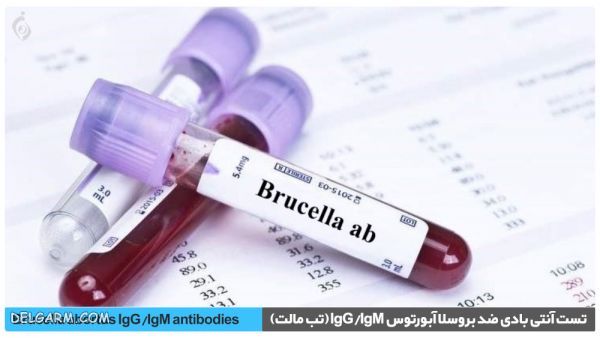 بروسلوز
