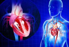 راههای جلوگیری از نارسایی قلبی در اثر حمله قلبی (2 نکته مهم)
