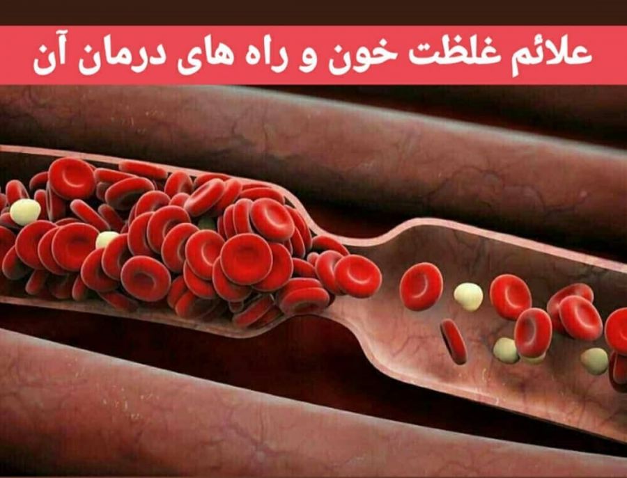 درمان غلظت خون با راهکارهای ساده و خوشمزه (2 نکته مهم)