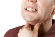 علائم عفونت فارنژیت یا التهاب حلق چیست و چگونه درمان میشود ؟ (2 نکته مهم)