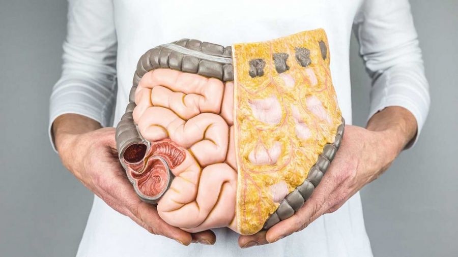 زخم دوازدهه چیست (Duodenal ulcer) چیست و چگونه درمان میشود ؟ (2 نکته مهم) زخم دوازدهه چیست (Duodenal ulcer) چیست و چگونه درمان میشود ؟ (2 نکته مهم)