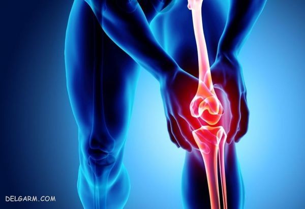علل تق تق زانو: آیا برای صدا دادن زانو باید به پزشک مراجعه شود؟