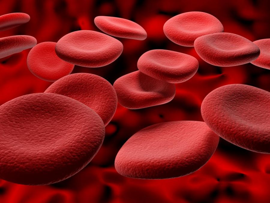 علائم اضافه بار آهن چیست و چگونه درمان میشود ؟ (2 نکته مهم)