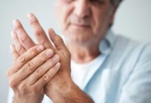 روماتیسم و آرتریت : تفاوت اصلی روماتیسم و آرتریت روماتوئید چیست ؟ (2 نکته مهم)