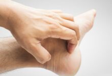 خارش پاشنه پا و دلایل مختلف آن (2 نکته مهم)