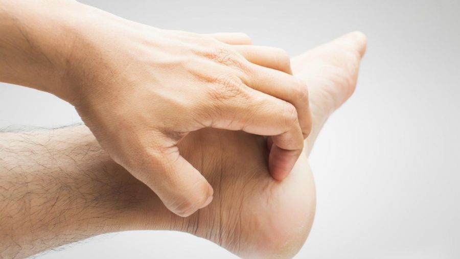 خارش پاشنه پا و دلایل مختلف آن (2 نکته مهم) خارش پاشنه پا و دلایل مختلف آن (2 نکته مهم)